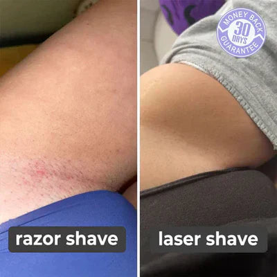 SILK SMOOTH™ - Laser Hair Remover (65% OFF TODAY ONLY!)